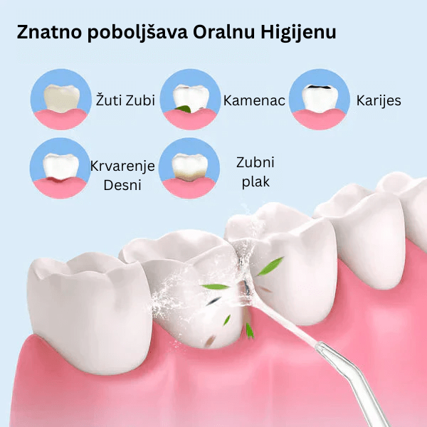 Oralni Čistač Zuba – Profesionalni Električni Irigator